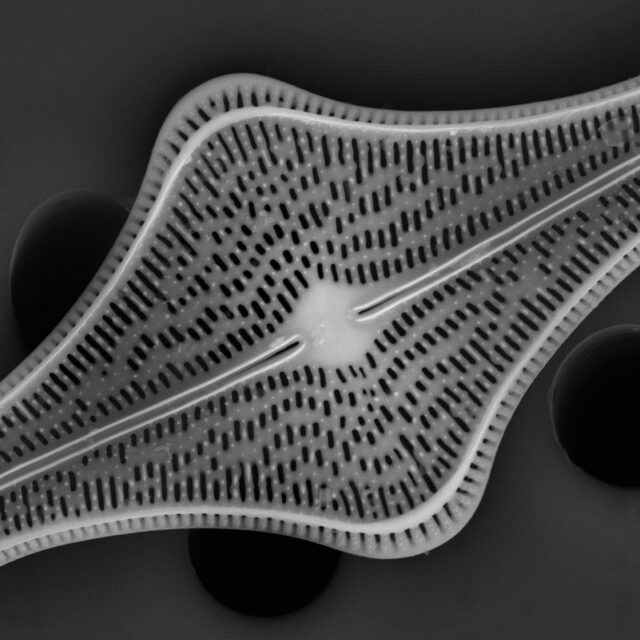 Brachysira follis SEM2