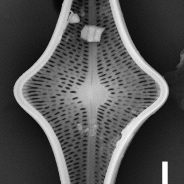 Brachysira follis SEM3