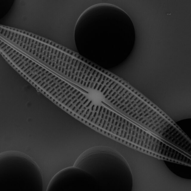 Brachysira neoexilis SEM1