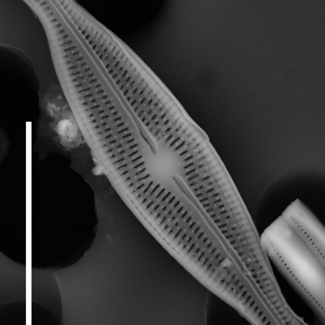 Brachysira neoexilis SEM2