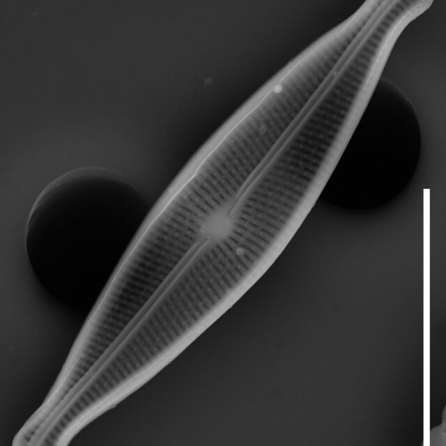 Brachysira neoexilis SEM3