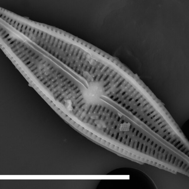 Brachysira sp 1 SEM1 INSTAAR 17658