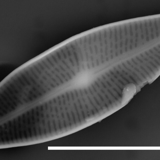 Brachysira sp 1 SEM2 INSTAAR 17660