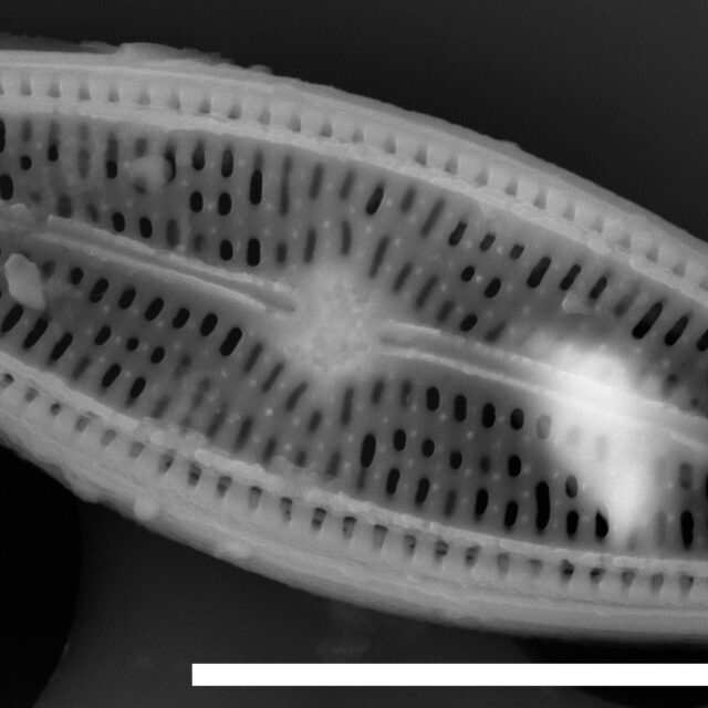 Brachysira sp 1 SEM3 INSTAAR 17658