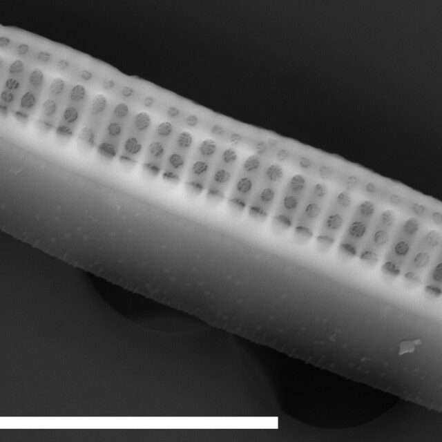 Denticula tenuis SEM1