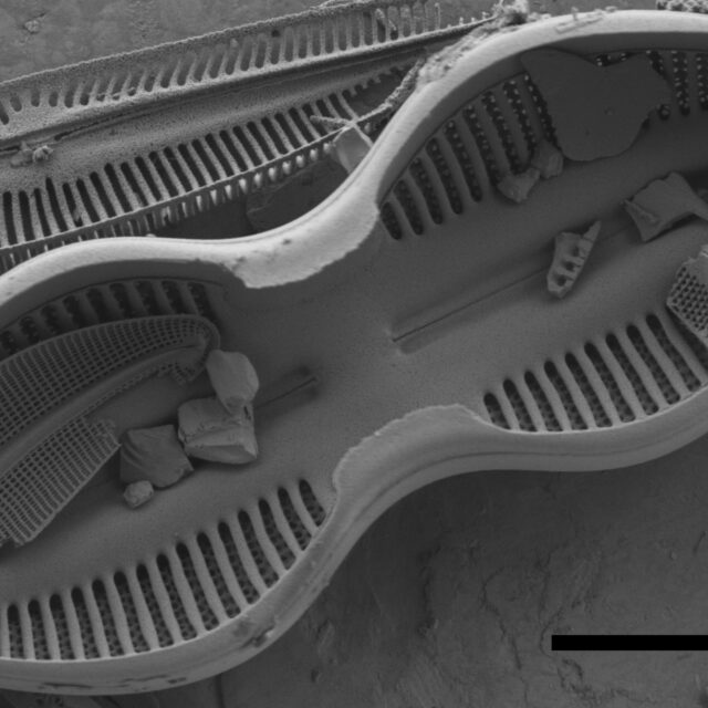 Diploneis interrupta SEM2
