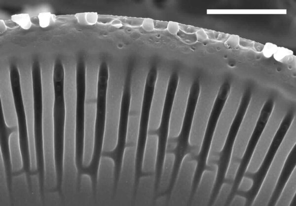 Encyonema yellowstonianum SEM5