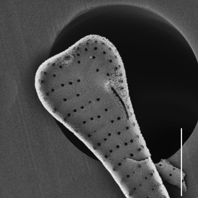 Eunotia Aasuminensis Sem Me 10011Unfiltered 041918 Mix 008