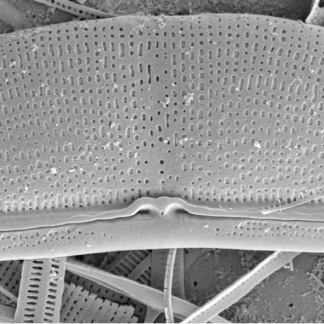 Halamphora baleenicola SEM1