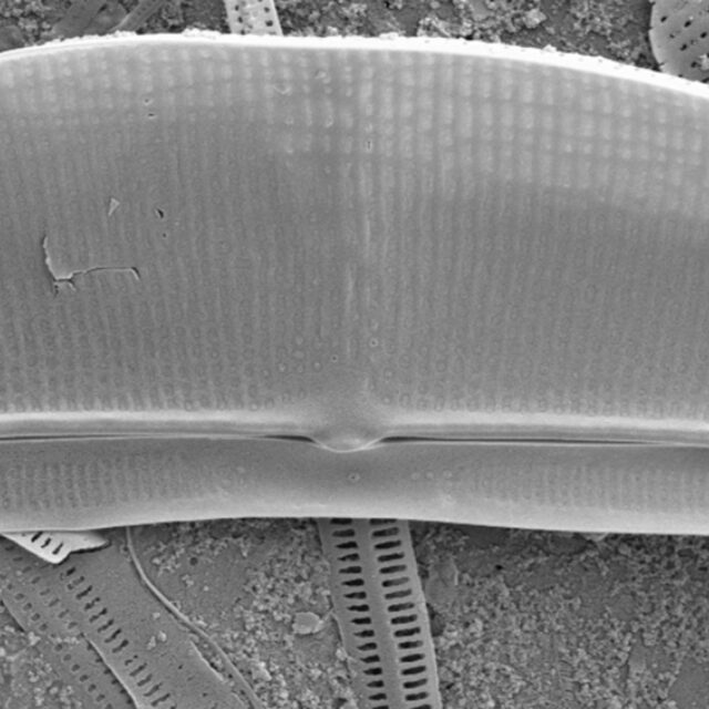 Halamphora baleenicola SEM2