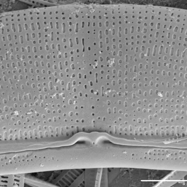 Halamphora baleenicola SEM3