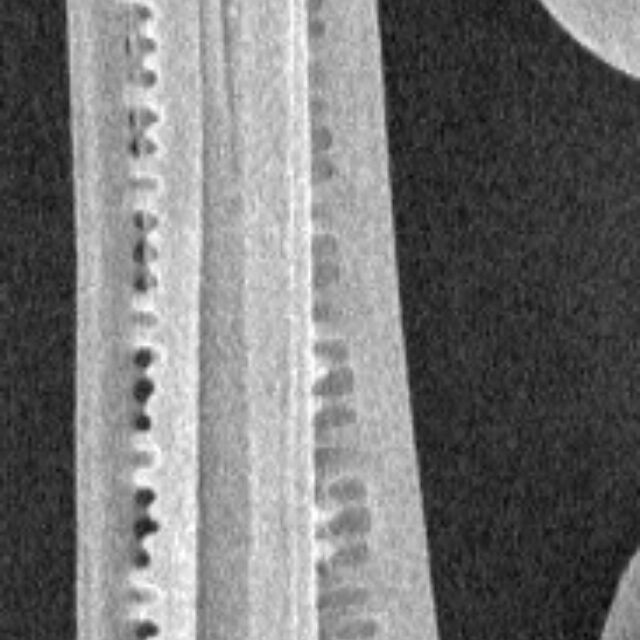 Idelicatissimaapex SEM