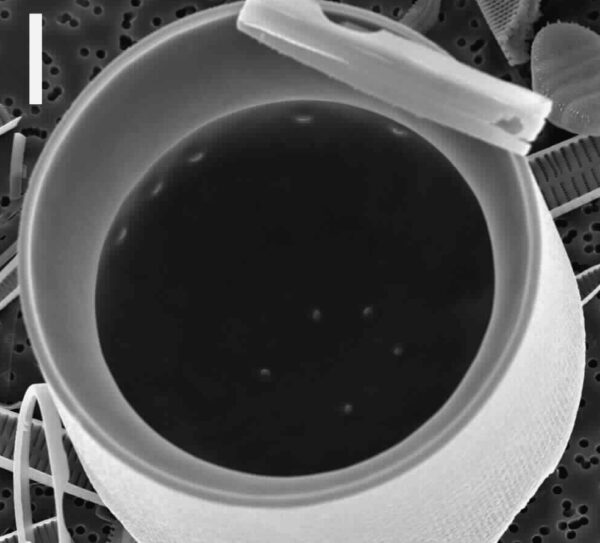 Melosira undulata SEM1