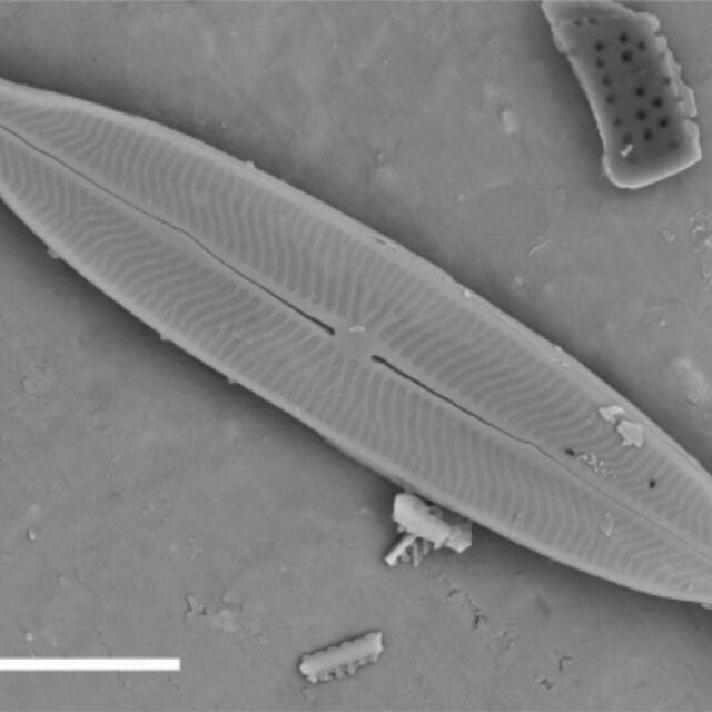 Kobayasiella tursujuqensis SEM1
