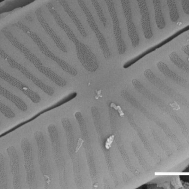 Kobayasiella tursujuqensis SEM2