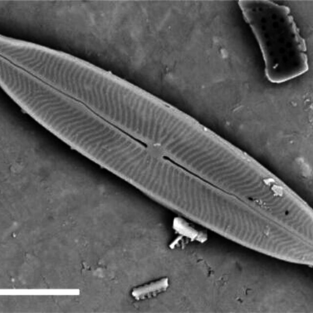 Kobaysiella tursujuqensis SEM1
