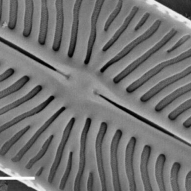 Kobaysiella tursujuqensis SEM2
