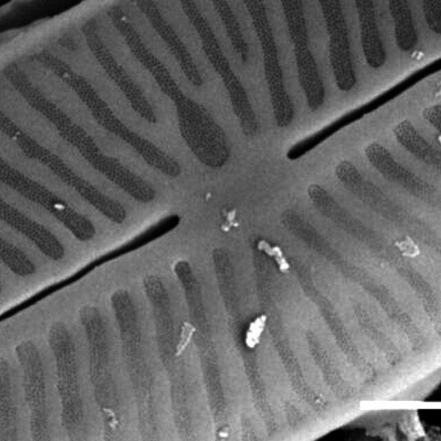 Kobaysiella tursujuqensis SEM3