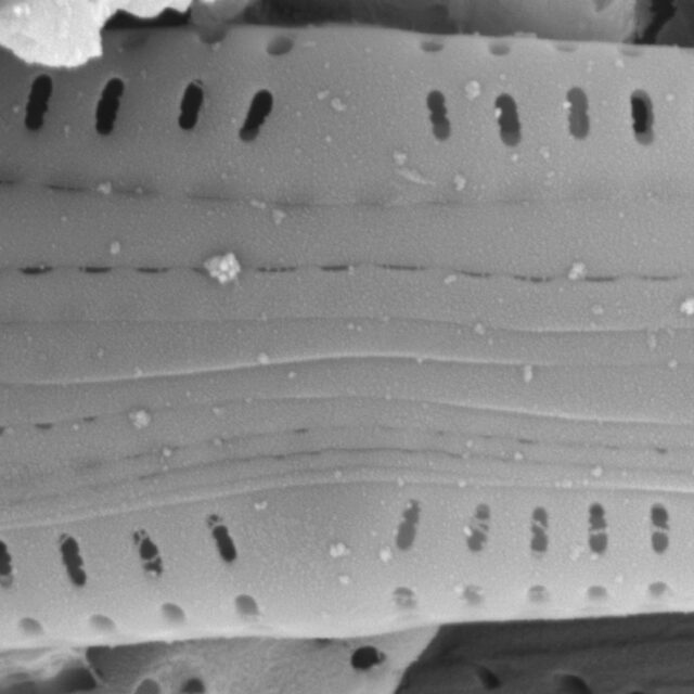 Medlinella amphoroidea SEM1