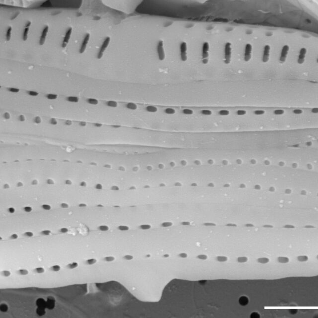 Medlinella amphoroidea SEM2