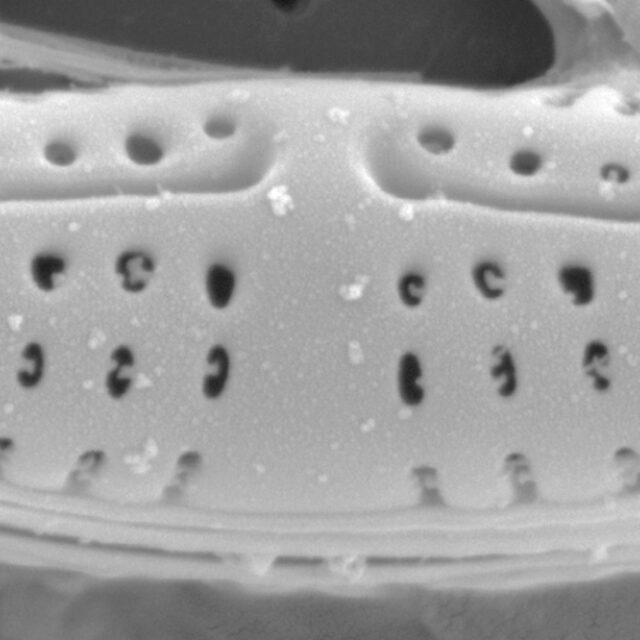 Medlinella amphoroidea SEM3