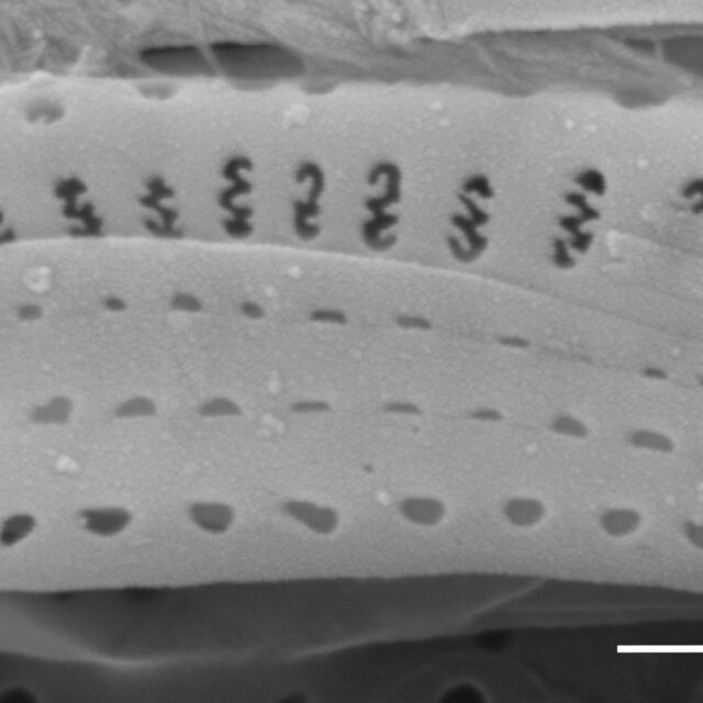 Medlinella amphoroidea SEM5