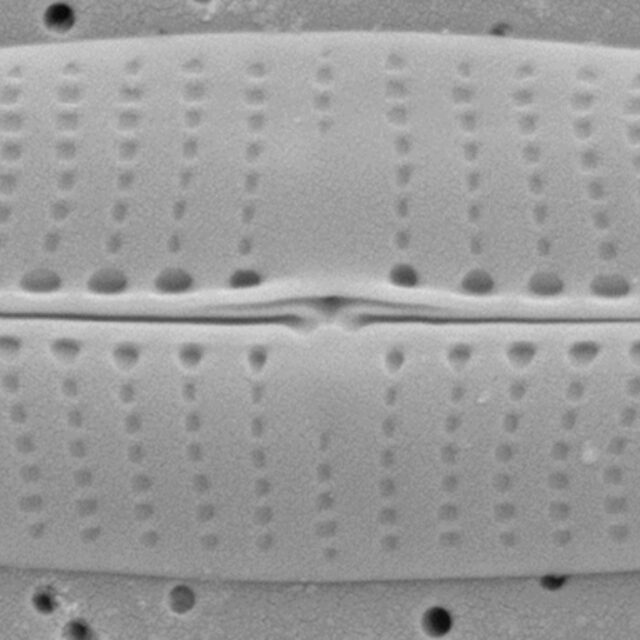 Proschkinia vergostriata SEM1