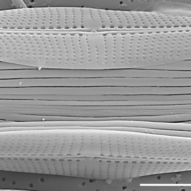 Proschkinia vergostriata SEM2