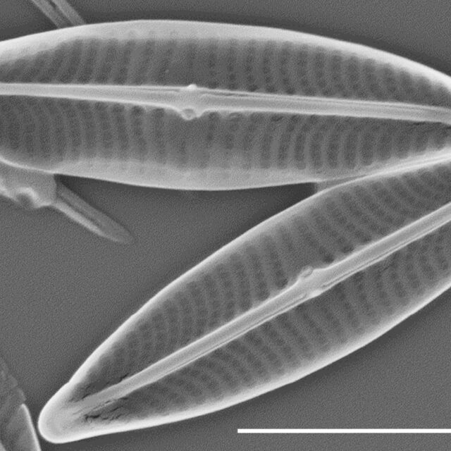 Proschkinia vergostriata SEM3