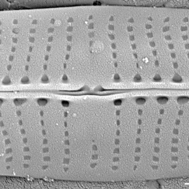 Proschkinia vergostriata SEM4