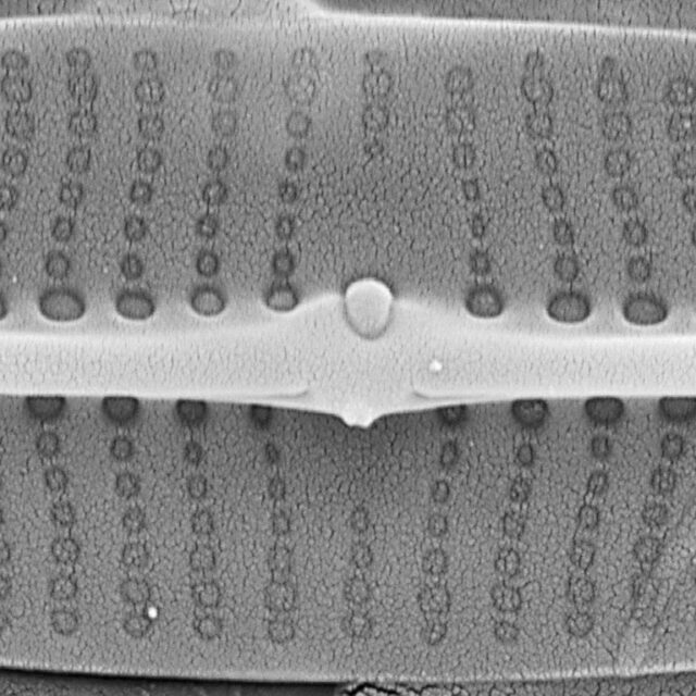 Proschkinia vergostriata SEM5