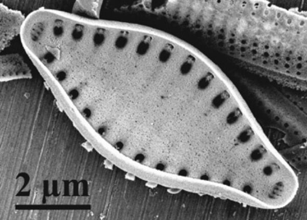 Pseudostaurosira microstriata SEM1