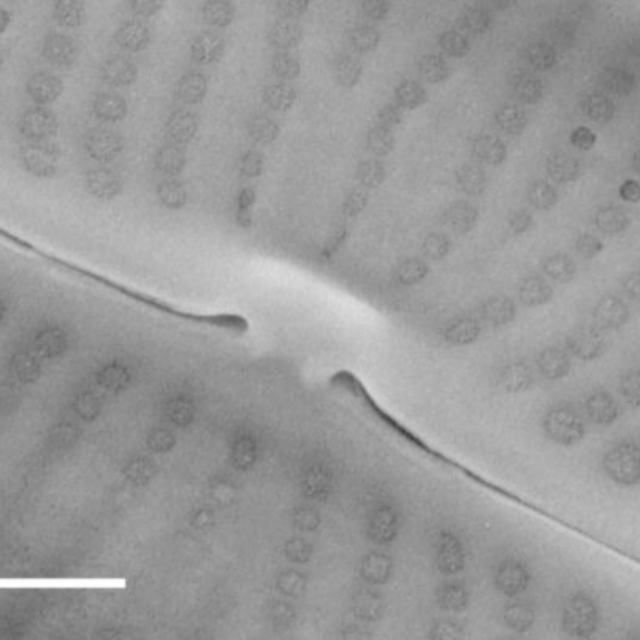 Sellaphora vincentiana SEM2