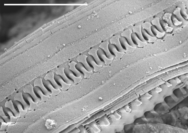 Staurosira construens var binodis SEM3