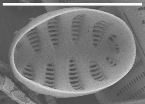 Staurosirella pinnata SEM1