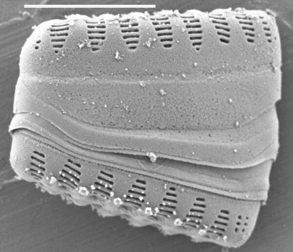 Staurosirella pinnata SEM2