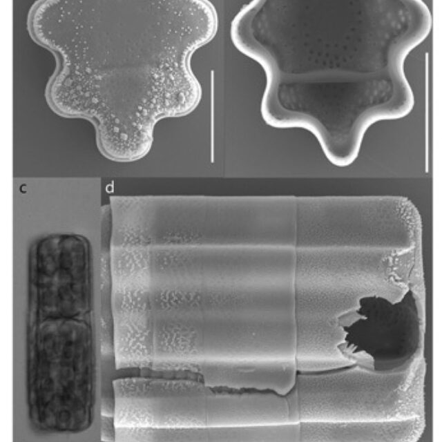 Stoermeria americana SEM 1