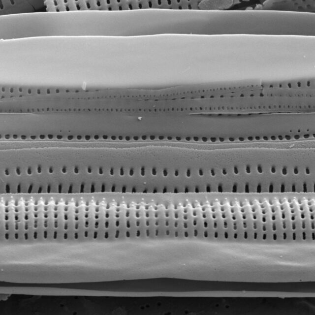 Tursiocola alata SEM1