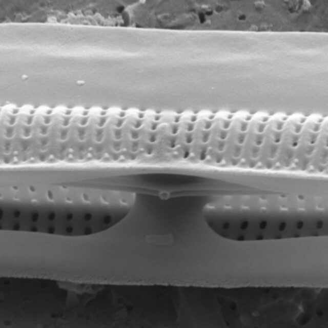 Tursiocola alata SEM4