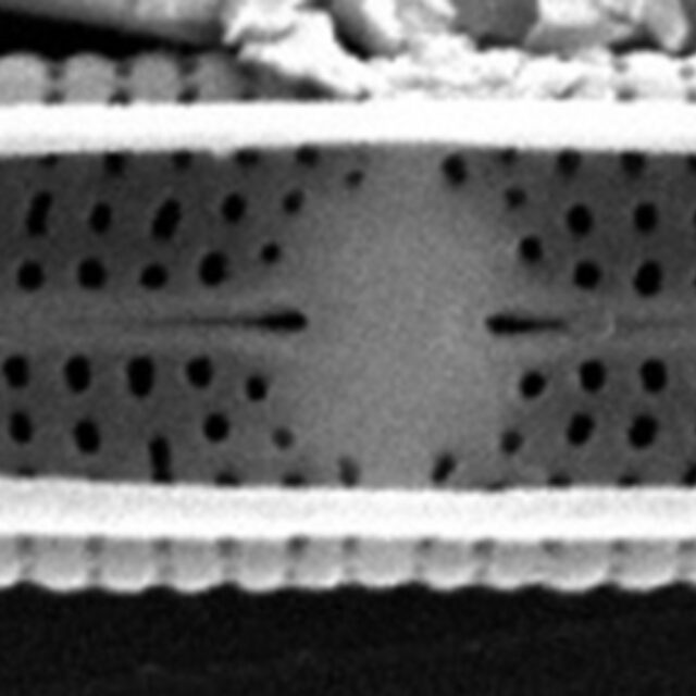 Tursiocola alata SEM5