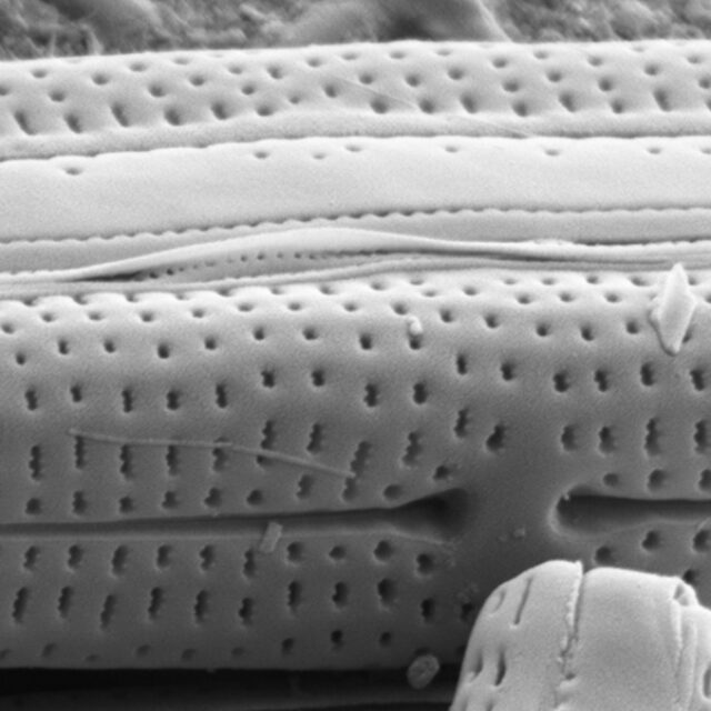 Tursiocola bondei SEM1