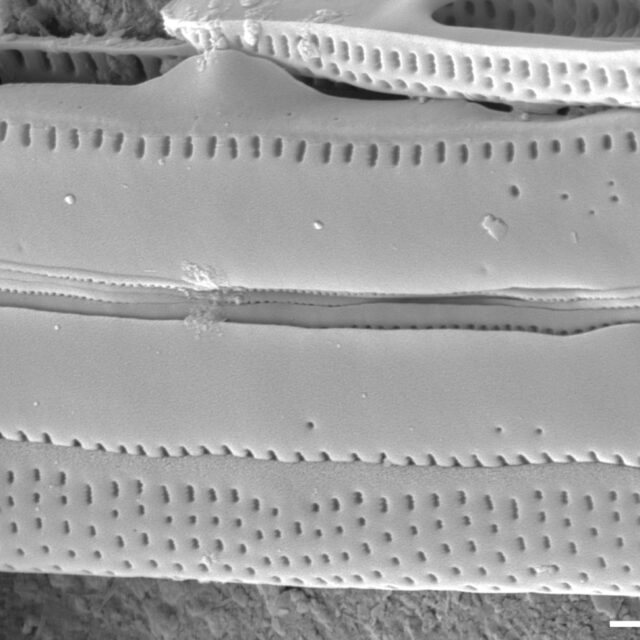 Tursiocola bondei SEM2