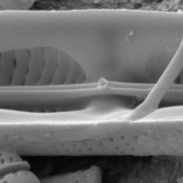 Tursiocola bondei SEM3