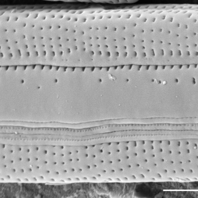 Tursiocola bondei SEM4