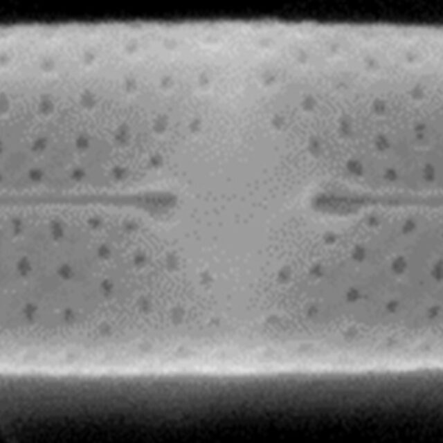 Tursiocola bondei SEM5