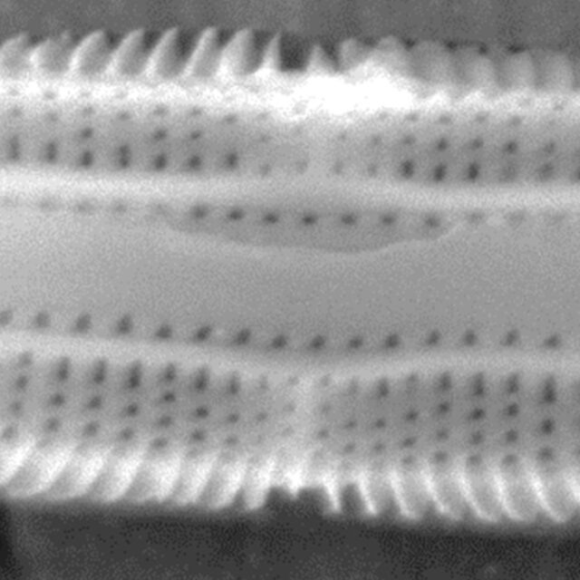 Tursiocola costata SEM1