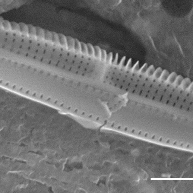 Tursiocola costata SEM2