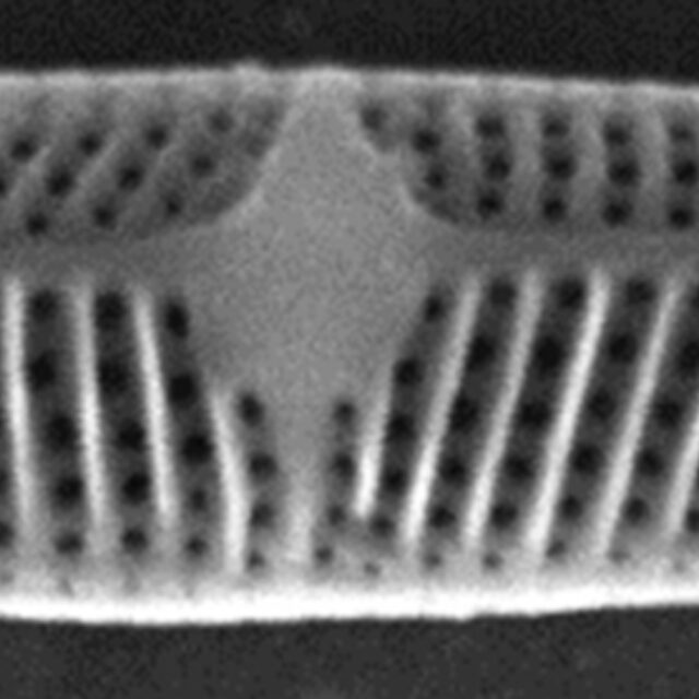 Tursiocola costata SEM3