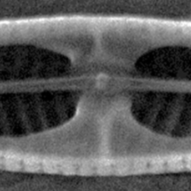 Tursiocola costata SEM4