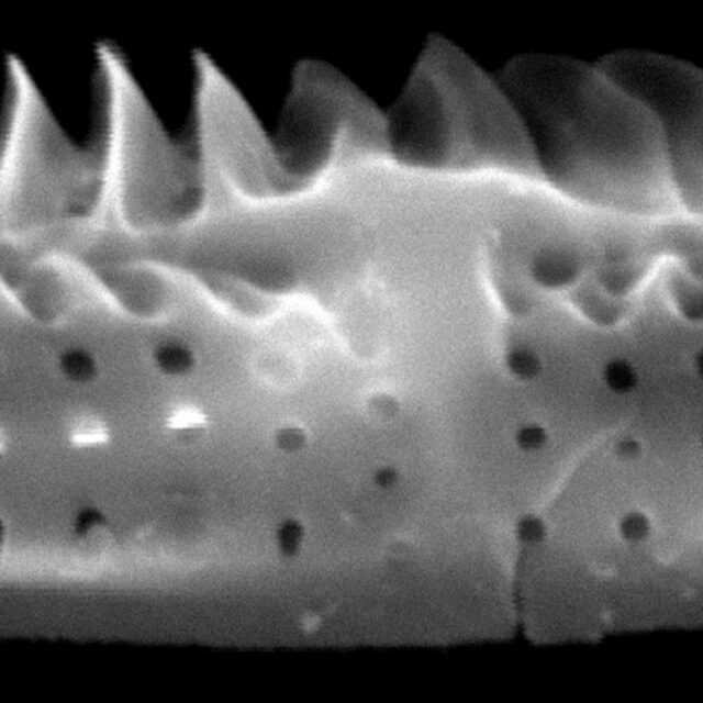 Tursiocola costata SEM5